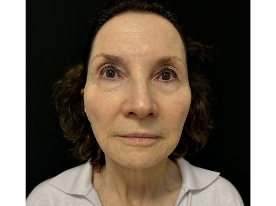 Wisconsin Vein Center & Medispa face after